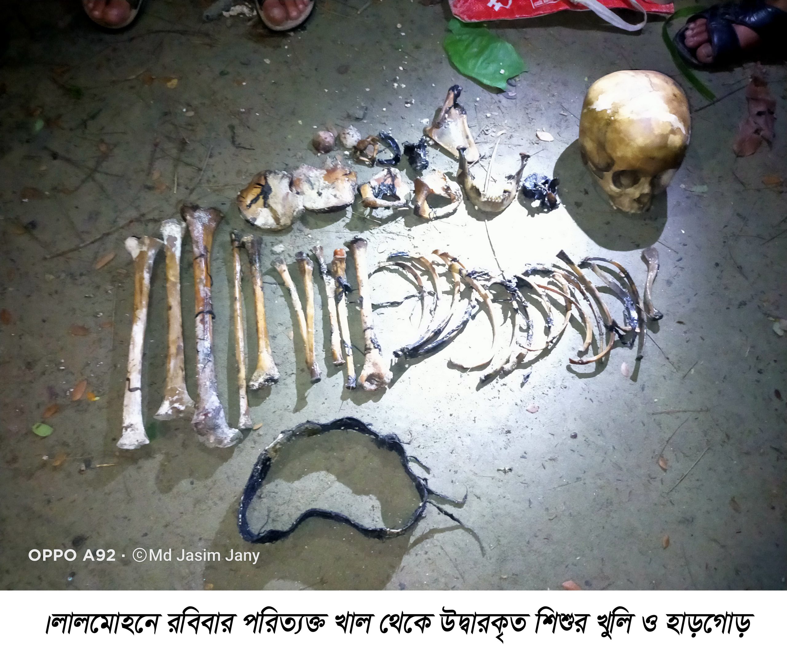 লালমোহনে খালে পাওয়া গেল শিশুর মাথার খুলি ও হাড়গোড়